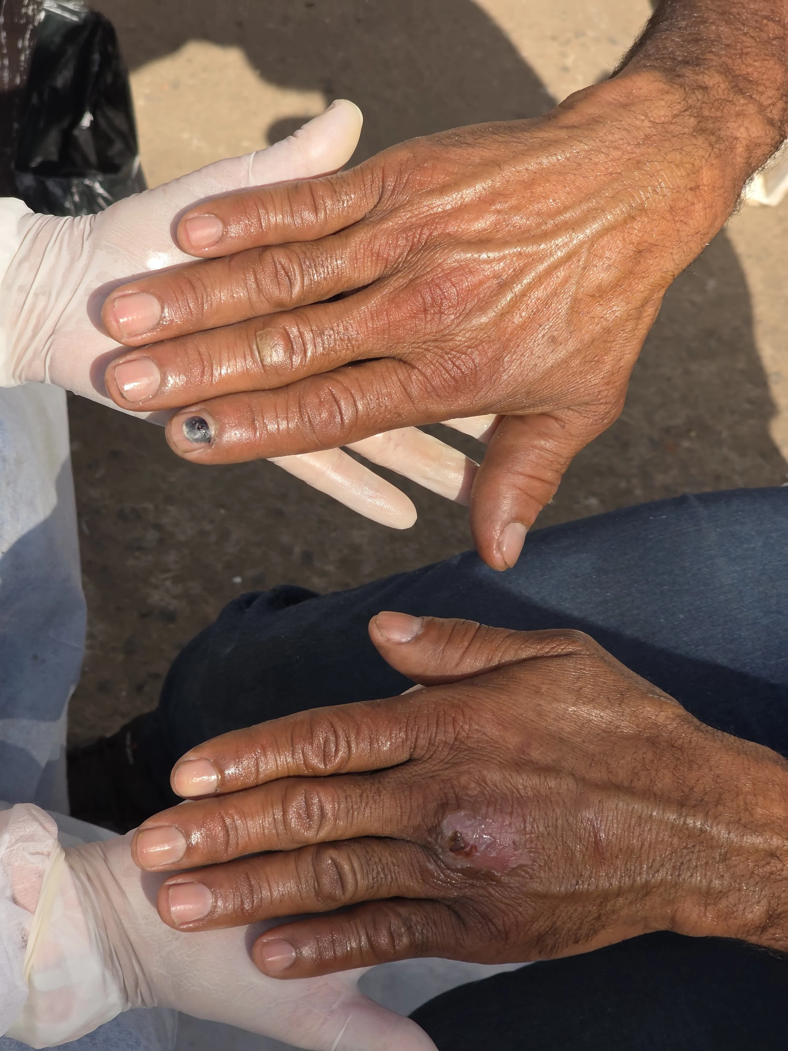 Mãos depois do tratamento